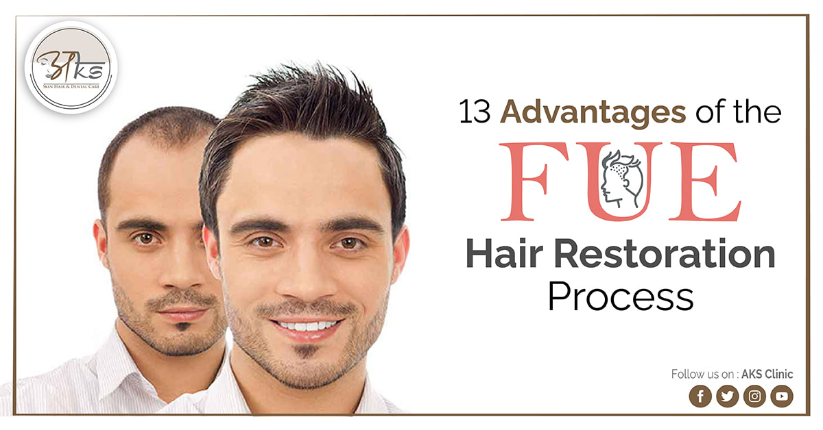 Primary Advantages of Fue Hair Restoration Process - Home